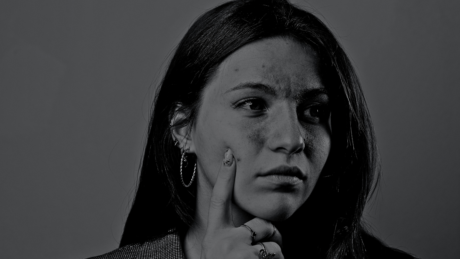 The Best Medicinal Mushrooms for Eczema by Antioxi