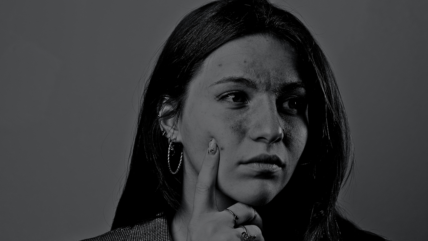 The Best Medicinal Mushrooms for Eczema by Antioxi