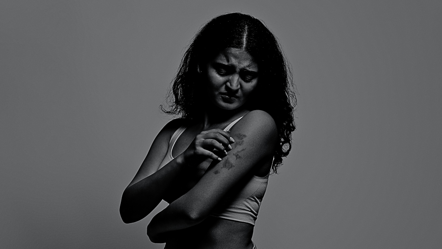 How to Treat Psoriasis: The Skin Benefits of Chaga Mushrooms by Antioxi